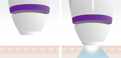 Фотоэпиляция с Silk-expert 3 IPL с сенсором тона кожи