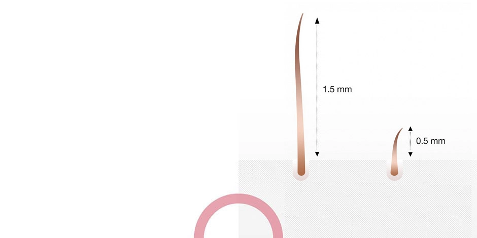 Как выбрать эпилятор